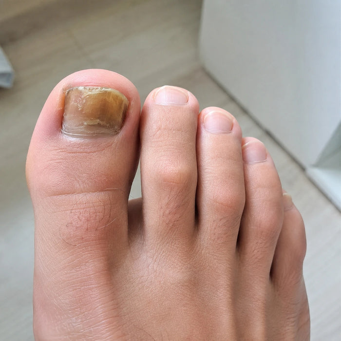 Giorno 1